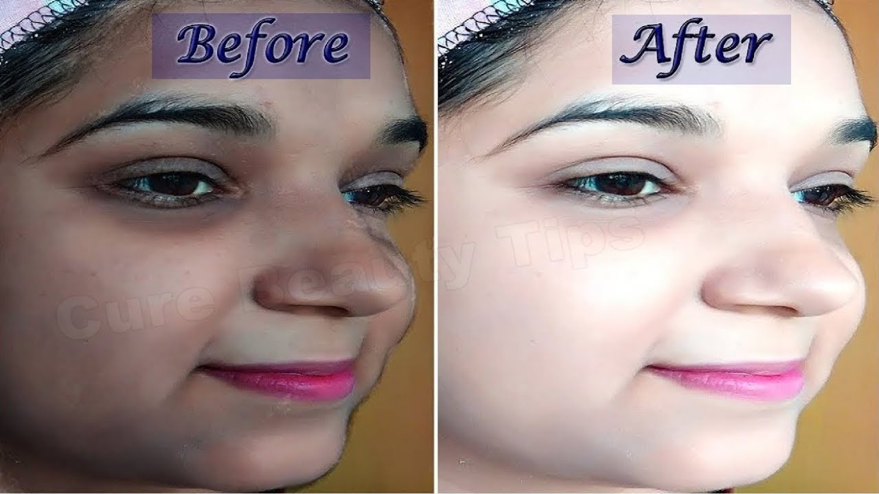 15 Minutes Skin Whitening Johnson Baby Oil Facial Bleach Get Fair