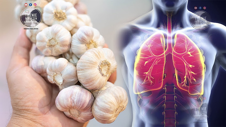 Habit mjeku i njohur: Konsumimi i hudhrës esëll trajton këto 10 semundje