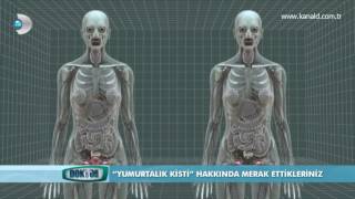 Yumurtalık Kisti ve Tedavi Yöntemleri