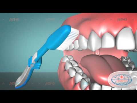 Гигиена полости рта: чистка имплантатов