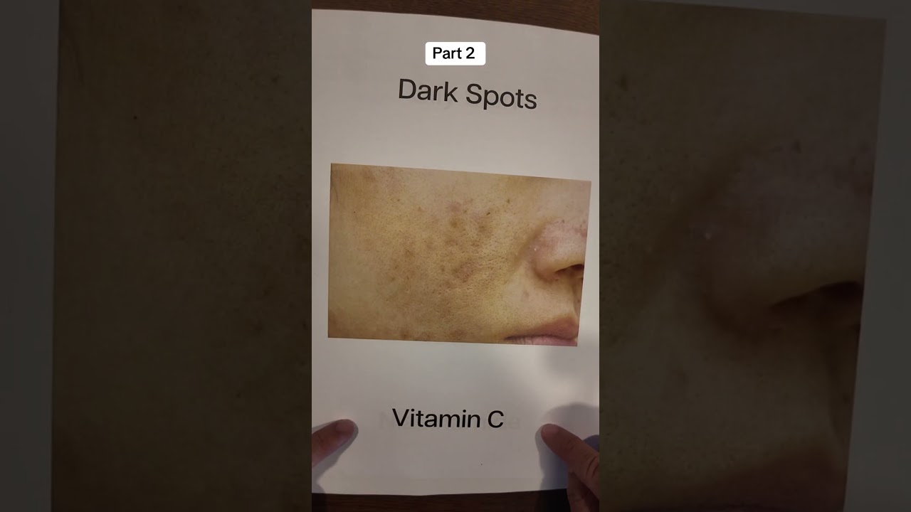 If you have this use this