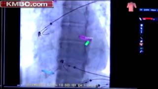 Hospital uses GPS technology in surgery