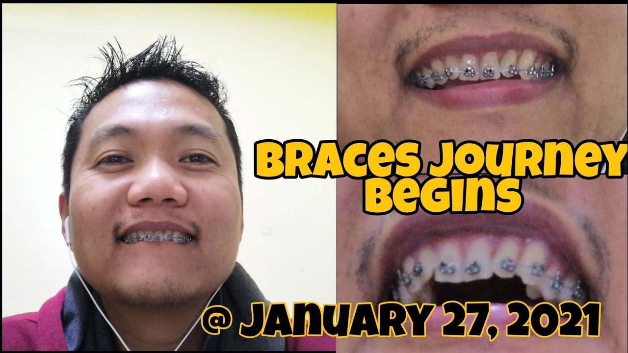 BRACES SA NGIPIN OFW IN SAUDI ARABIA YouTube