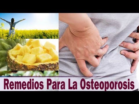 remedios caseros para la osteoporosis avanzada 7 Homemade REMEDIES For Osteoporosis [DO NOT KNOW THIS!]