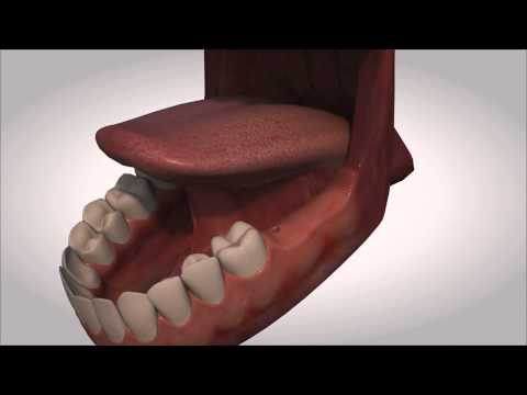 Імплантовод універсальний 500550, видео 1