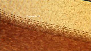 ANGLE plc - How the Parsortix system works
