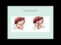 Bilirubin 2 - Bilirubin Metabolism & Diseases - YouTube