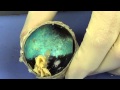 Cow Eye Dissection Quiz