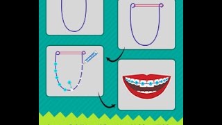Diy Guide On How To Make Fake Braces That Look Real