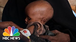 Millions Face Food Insecurity In Somalia's Worst Drought For 40 Years