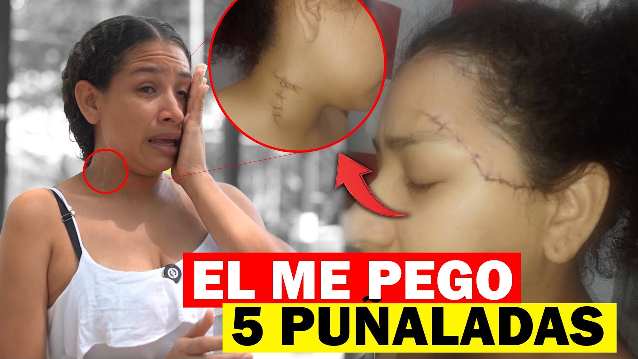 Sobreviví de MILAGRO… Mi PAREJA me pego 5 PUÑALADAS 😔😨 EPISODIO 1
