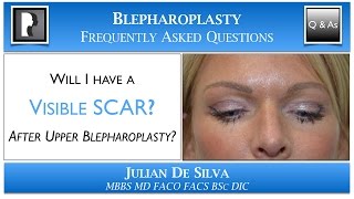 Will I have a Visible Scar after Upper Blepharoplasty? Scar after an upper eyelid lift?