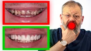 видео: Здоровые зубы. 3 упражнения за 3 минуты в день! картинка: Здоровые зубы. 3 упражнения за 3 минуты в день!
