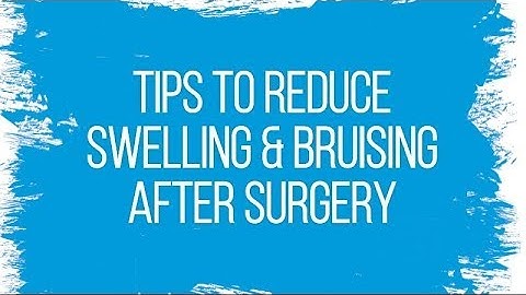 Tips to Reduce Swelling & Bruising After Surgery