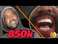 Kanye West replaces all his teeth with titanium dentures