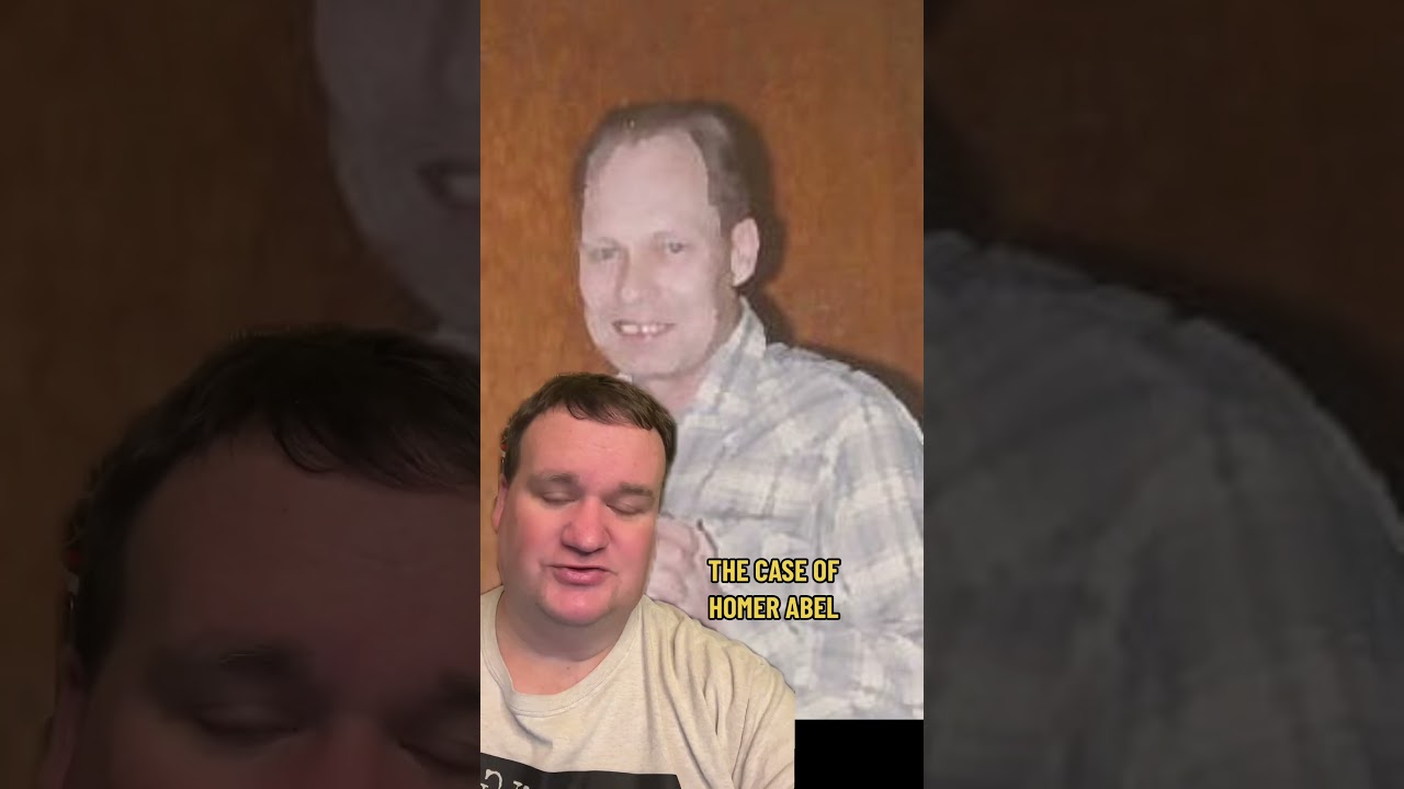 One Minute Case: Homer Abel 