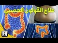 د. محمد الفايد ماهو القولون العصبي ، أعراضه وعلاجه !
