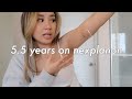 5.5 YEARS on Nexplanon Birth Control Implant | Removal + Reinsertion vlog, Side Effects, & Review