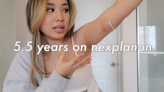 5.5 YEARS on Nexplanon Birth Control Implant | Removal + Reinsertion vlog, Side Effects, & Review