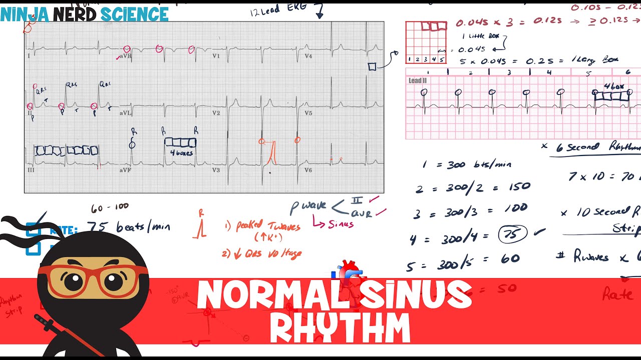 Rate And Rhythm Normal Sinus Rhythm Youtube