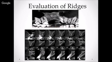CBCT IMAGING IN GUIDED SURGERY