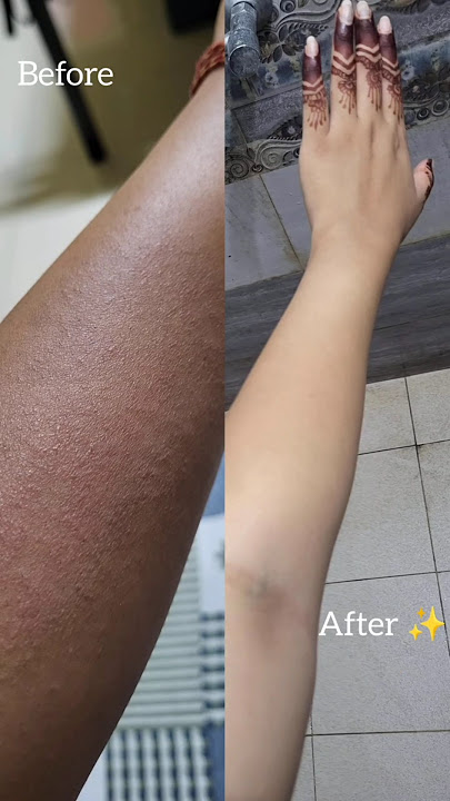 How I detan my arms using one product! #skincare #detan #tanfreeskin #tanremoval