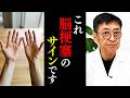 【医師解説】放置厳禁！脳梗塞が起こる前に現れる「手の危険サイン」と「ミニ脳梗塞」の正体