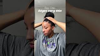 These edges went from receding to thick in half a year #edgesgrowth #hairjourney #beforeandafter