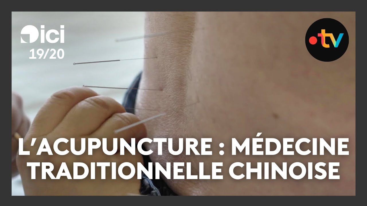 L'acupuncture : médecine traditionnelle chinoise sans médicament