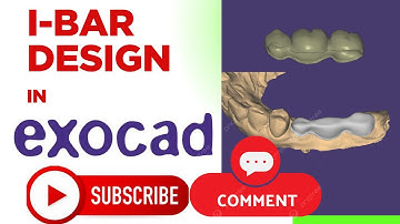 i bar design in exocad