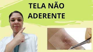 TELA NÃO ADERENTE NO TRATAMENTO DE FERIDAS