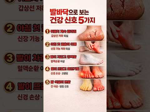 발바닥에 이 5가지 보이면 장기가 망가지고 있다는 신호입니다