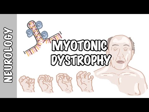 Video: Vilka är symptomen på myotonisk dystrofi?