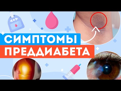 10 ГЛАВНЫХ СИМПТОМОВ ПРЕДДИАБЕТА | ВАЖНО ЗНАТЬ!