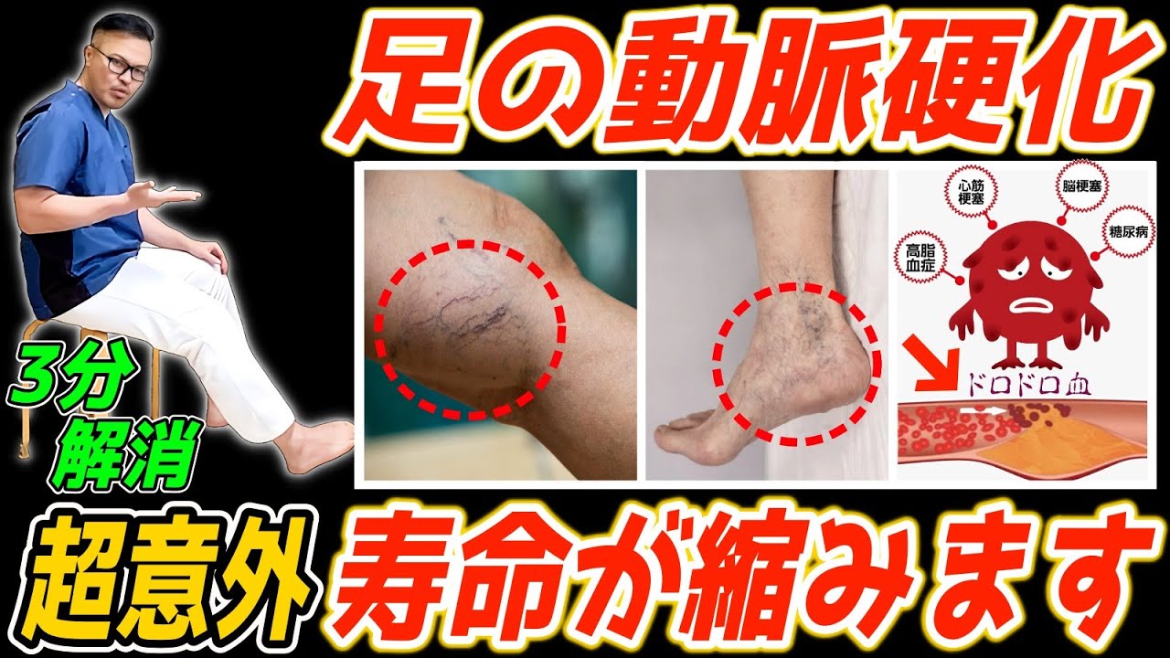 【知らないと後悔する】ガンより死亡率が高い「足の動脈硬化」危険なサインとお手軽な予防セルフケア方法！（老化防止｜内臓脂肪・中性脂肪｜足腰の衰え｜腰痛・股関節痛・膝痛・足首/裏/指の痛み）