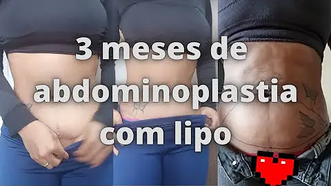 Pode pintar o cabelo depois de uma cirurgia?