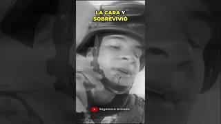 Recibe un disparo en la cara y SOBREVIVE #jalisco #short #guadalajara #datoscurisos