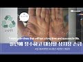 말년에 장수하고 대성할 삼지창 손금[C.C자막]/Trident palm lines that will last a long time and succeed in life.