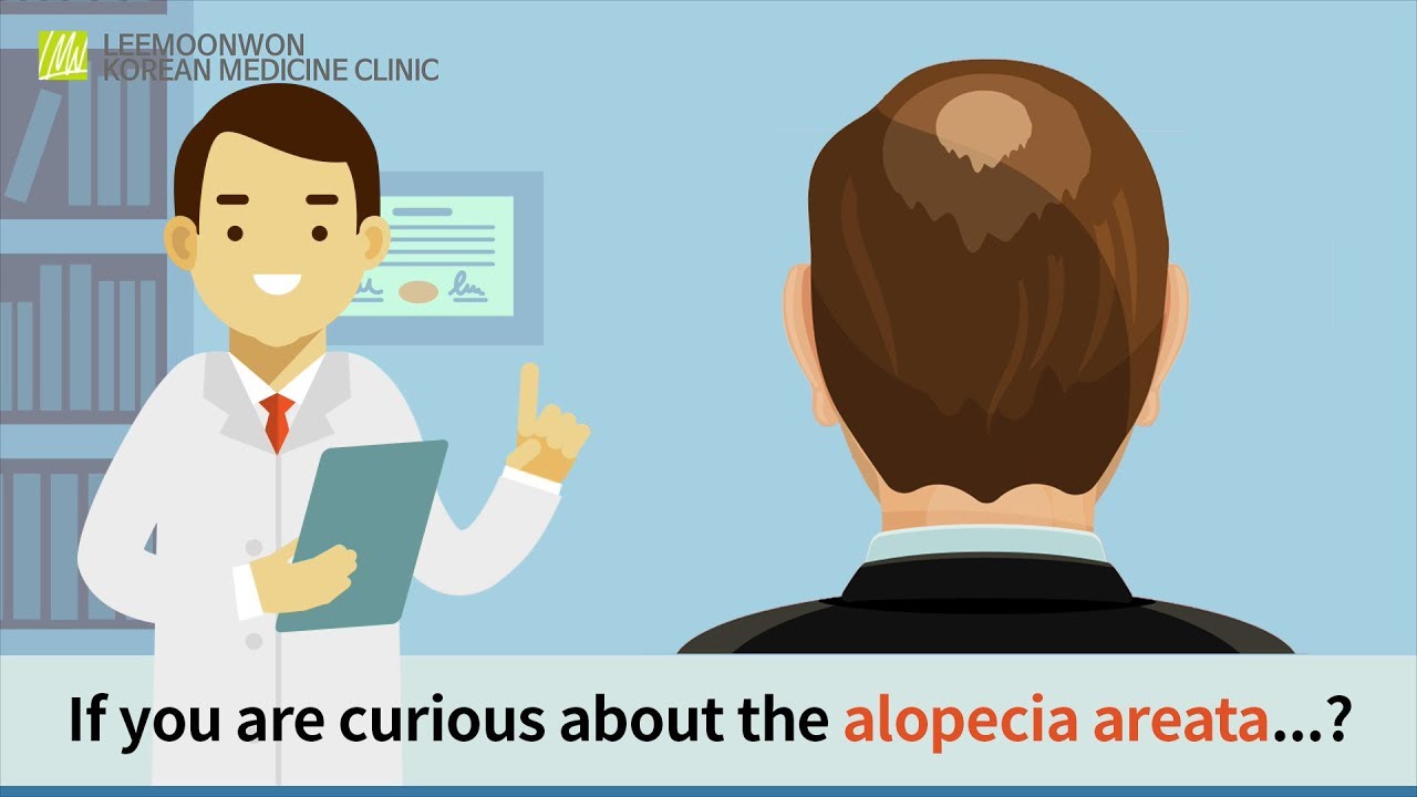 If you are curious about the alopecia areata...? If you are curious about the alopecia areata...?