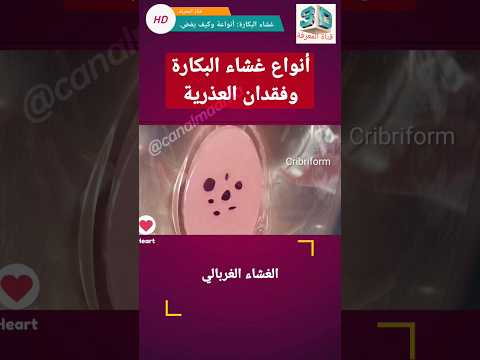 فيديو: ما جذر كلمة تعني غشاء؟