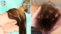 Wanita Wajib Nonton !!! Cara Mengatasi Rambut Rontok Secara Pemanen - Durasi: 6.26. 