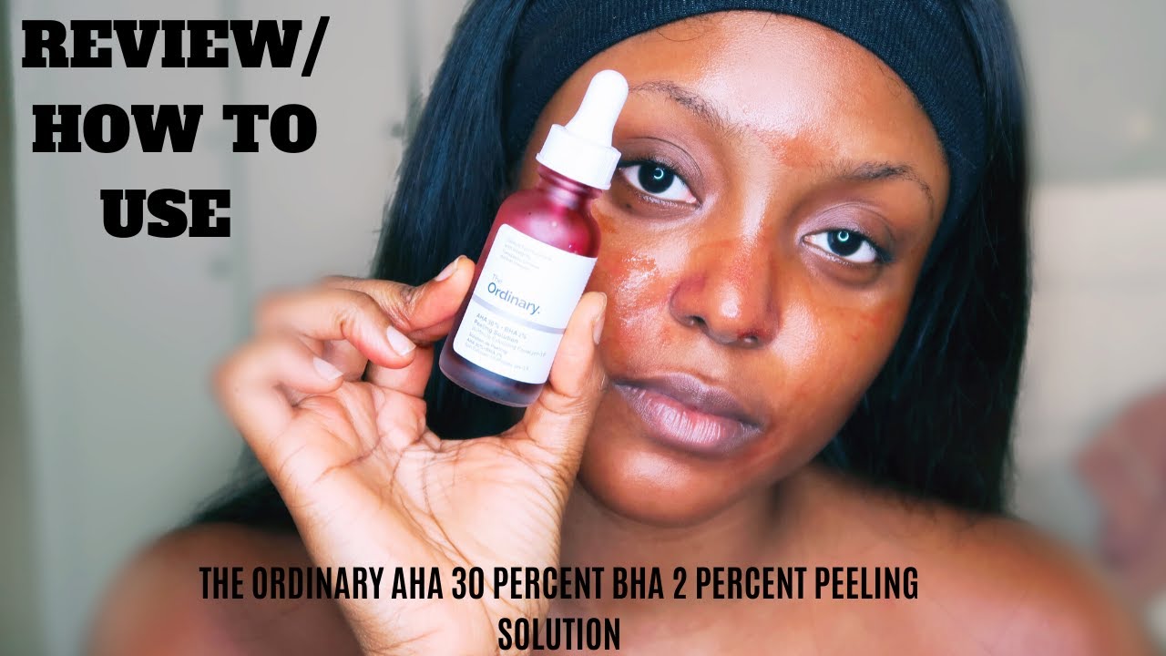 the ordinary peeling solution review acne