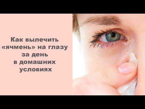 Как вылечить ячмень на глазу за день в домашних условиях