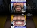 Jalandhar Best Hospital dental surgery low-cost dental implant in Jalandhar near Chunmun Mall