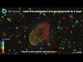Label-free Observation of Organoid Growth