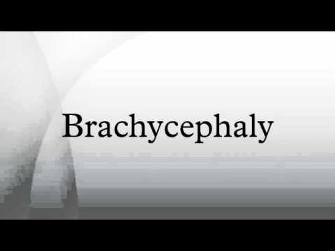 Brachycephaly