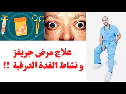نبذة عن علاج مرض جريفز و نشاط الغدة الدرقية