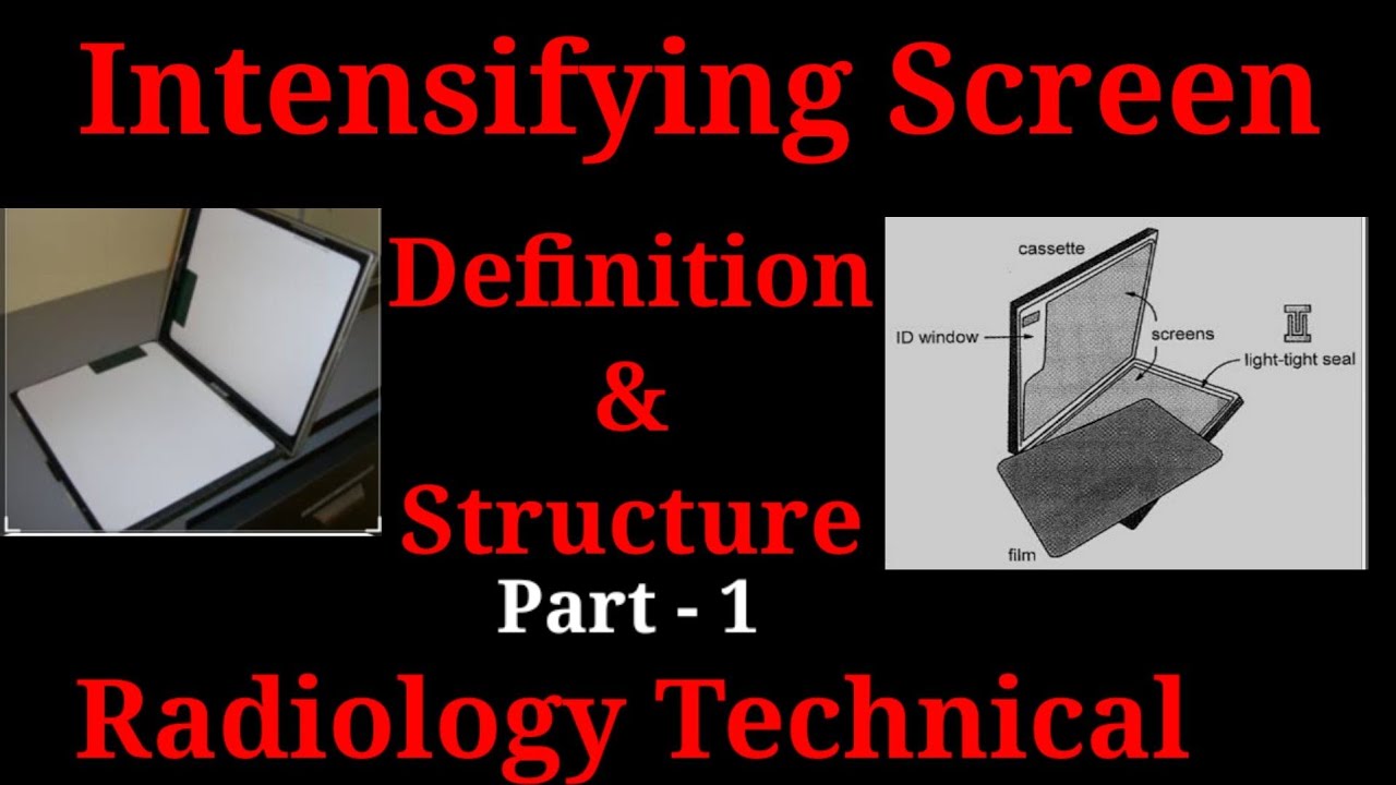 Intensifying Screen Defination Structure Radiology Technical Intensifying Screen Defination Structure Radiology Technical