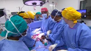 Conjoined twins separated in Haiti