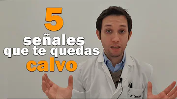 ¿Qué te hace más propenso a quedarte calvo?